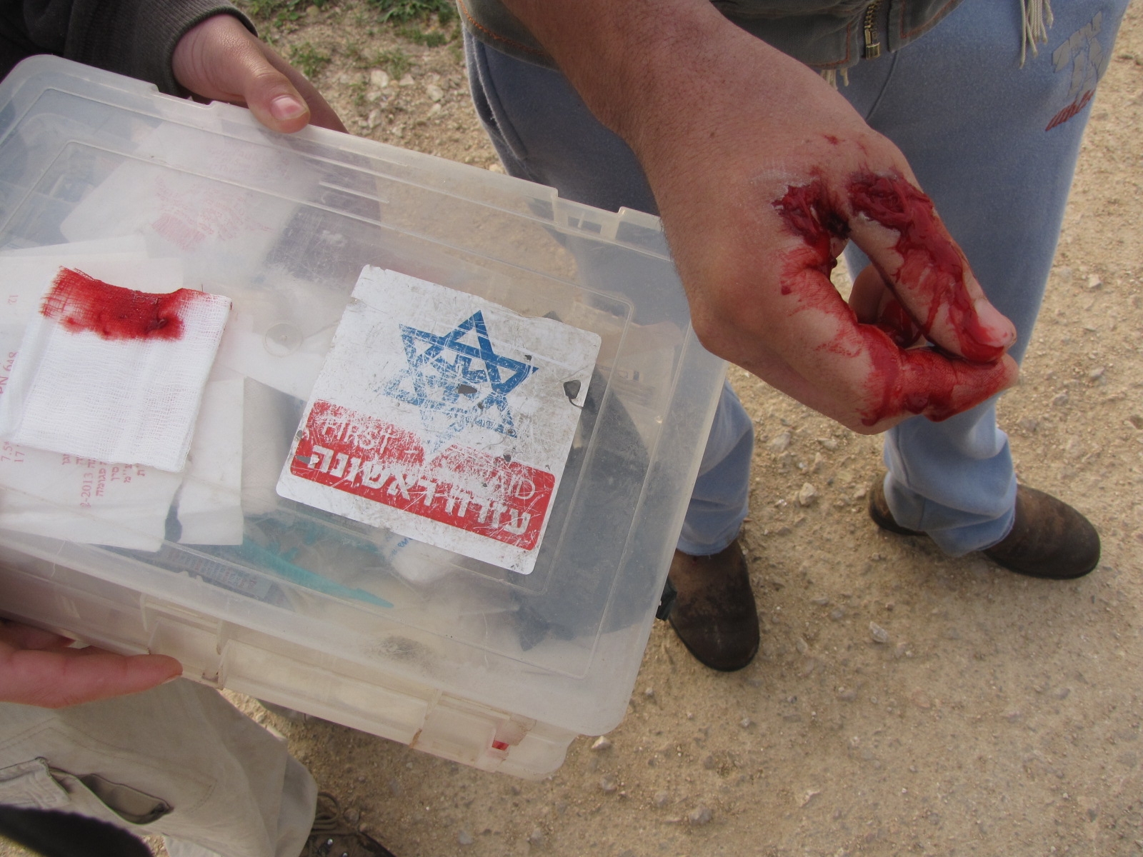תלונה למח"ש: מי הורה לירות כדורי גומי במתנחלים