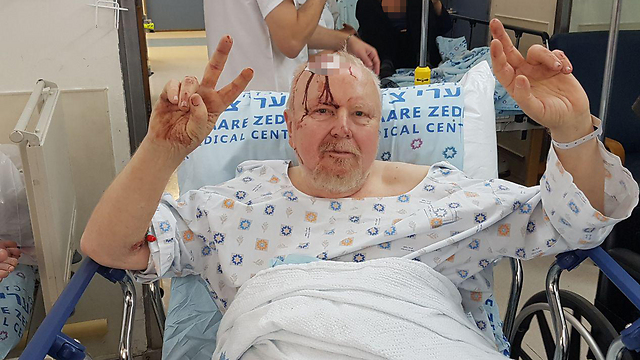'נס גדול' • אחד הפצועים: אביה של אלישבע פדרמן
