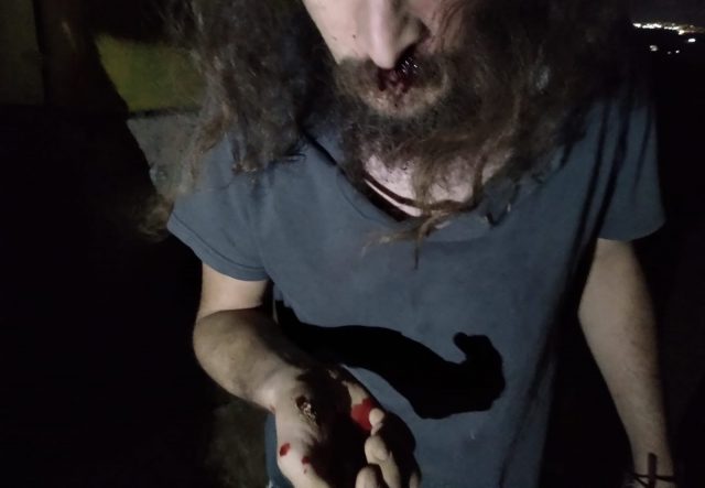 תושב נפצע בפניו כתוצאה מאגרוף של שוטר.