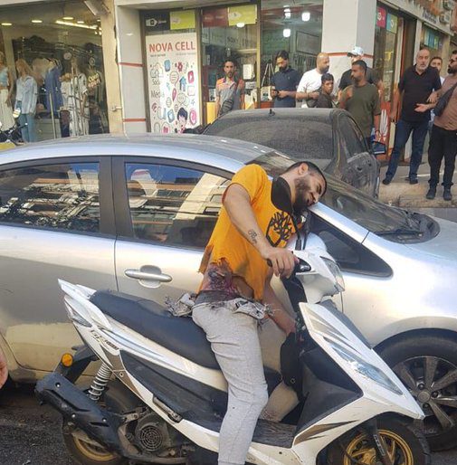 מתקפת הביפרים בלבנון: 500 מחבלים איבדו את עיניהם