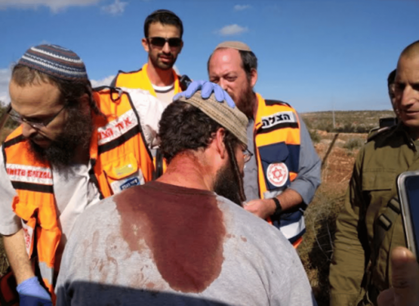 אחד המלווים שנפצע בראשו