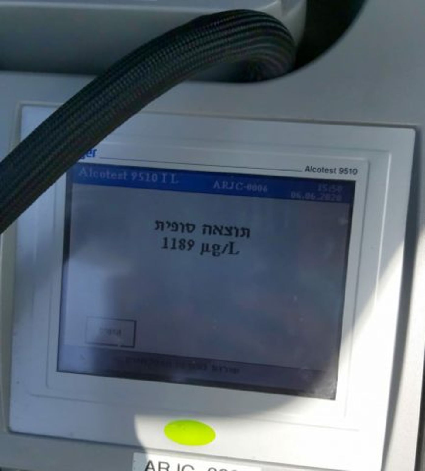 תוצאת בדיקת הינשוף (דוברות המשטרה)