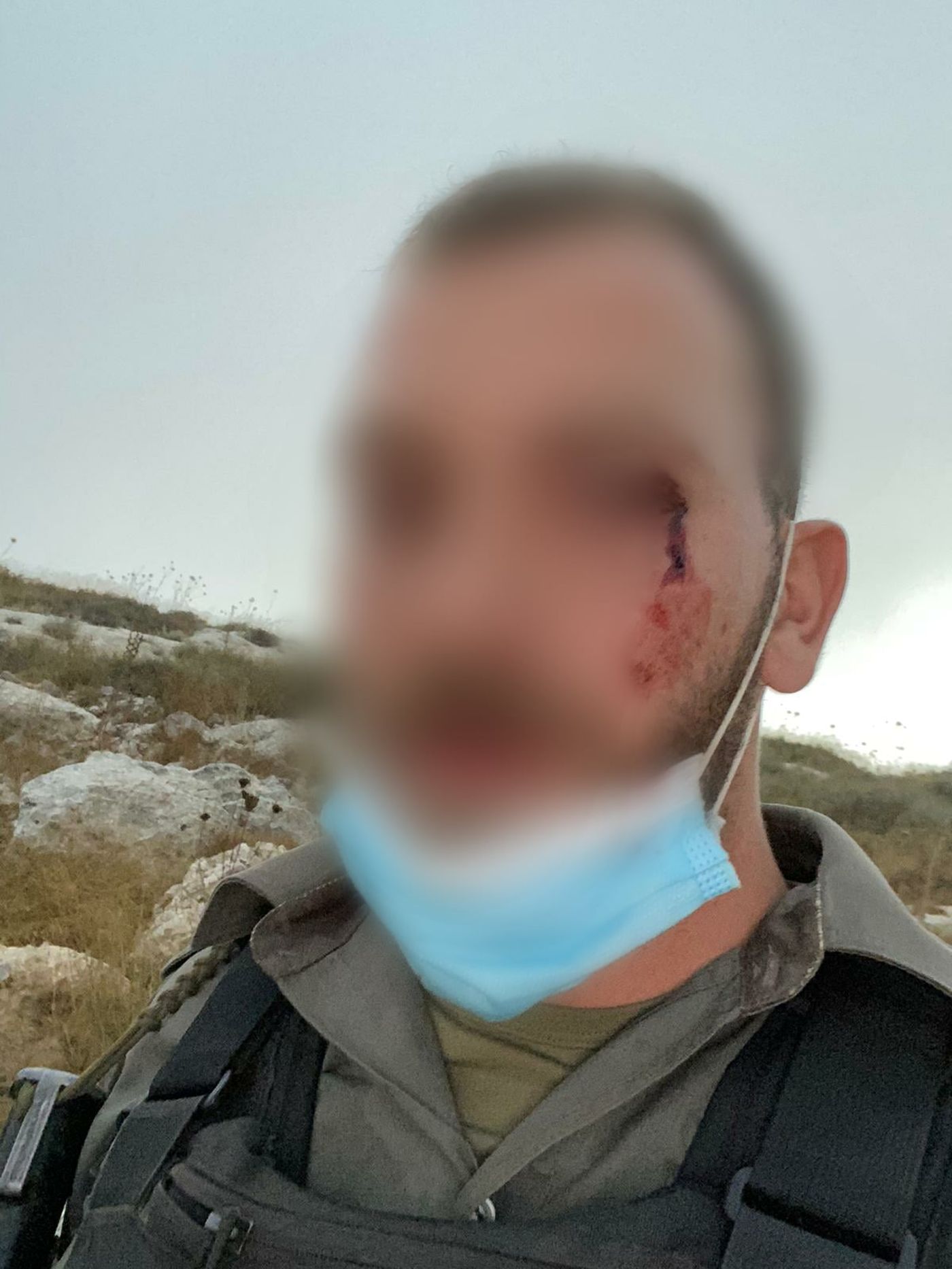 המשטרה: יהודים תקפו לוחמי מג"ב בסמוך ליצהר