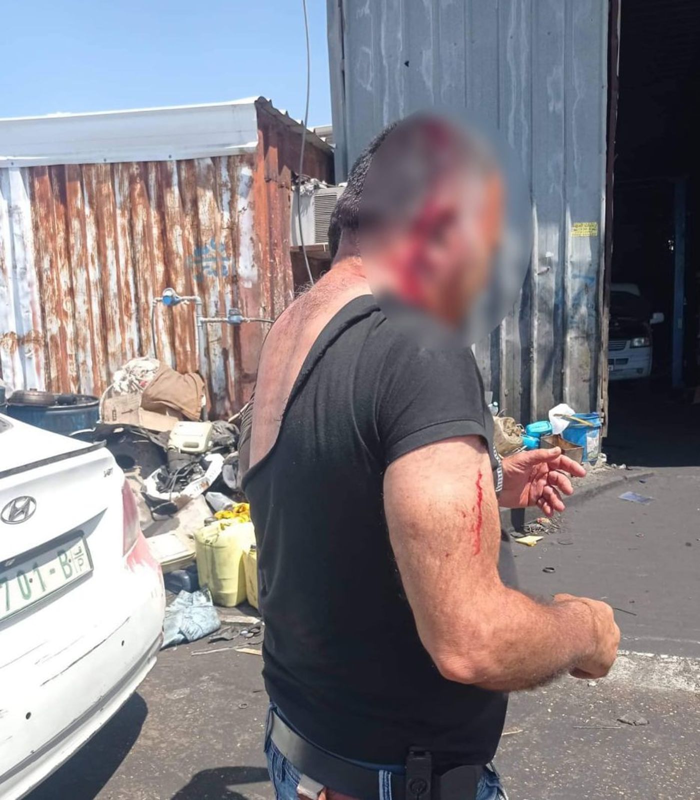 יהודי הותקף ע"י ערבים בכפר נבי אליאס