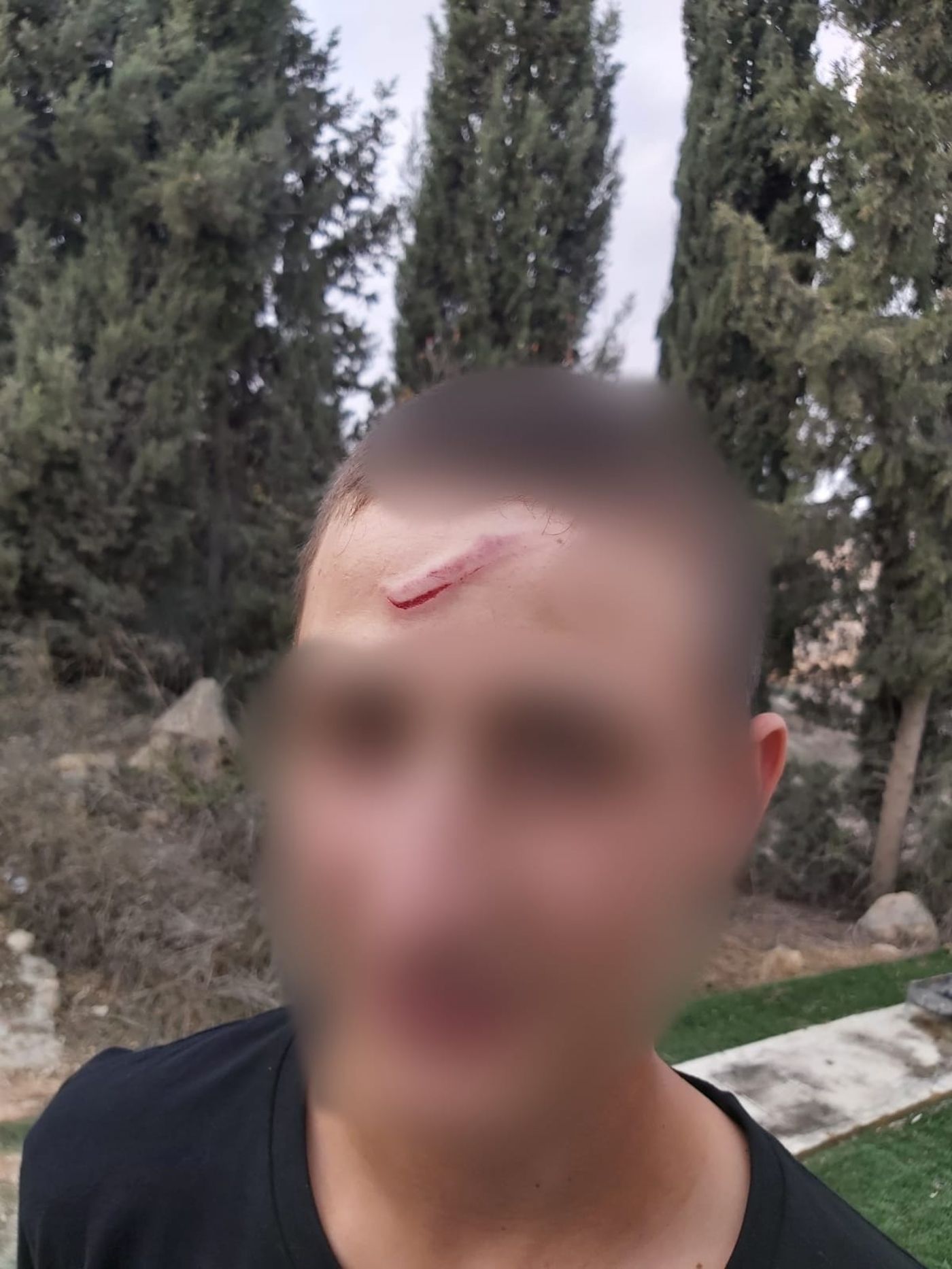 במחאה על הפיגוע: שוטר מג"ב פצע נער בן 14
