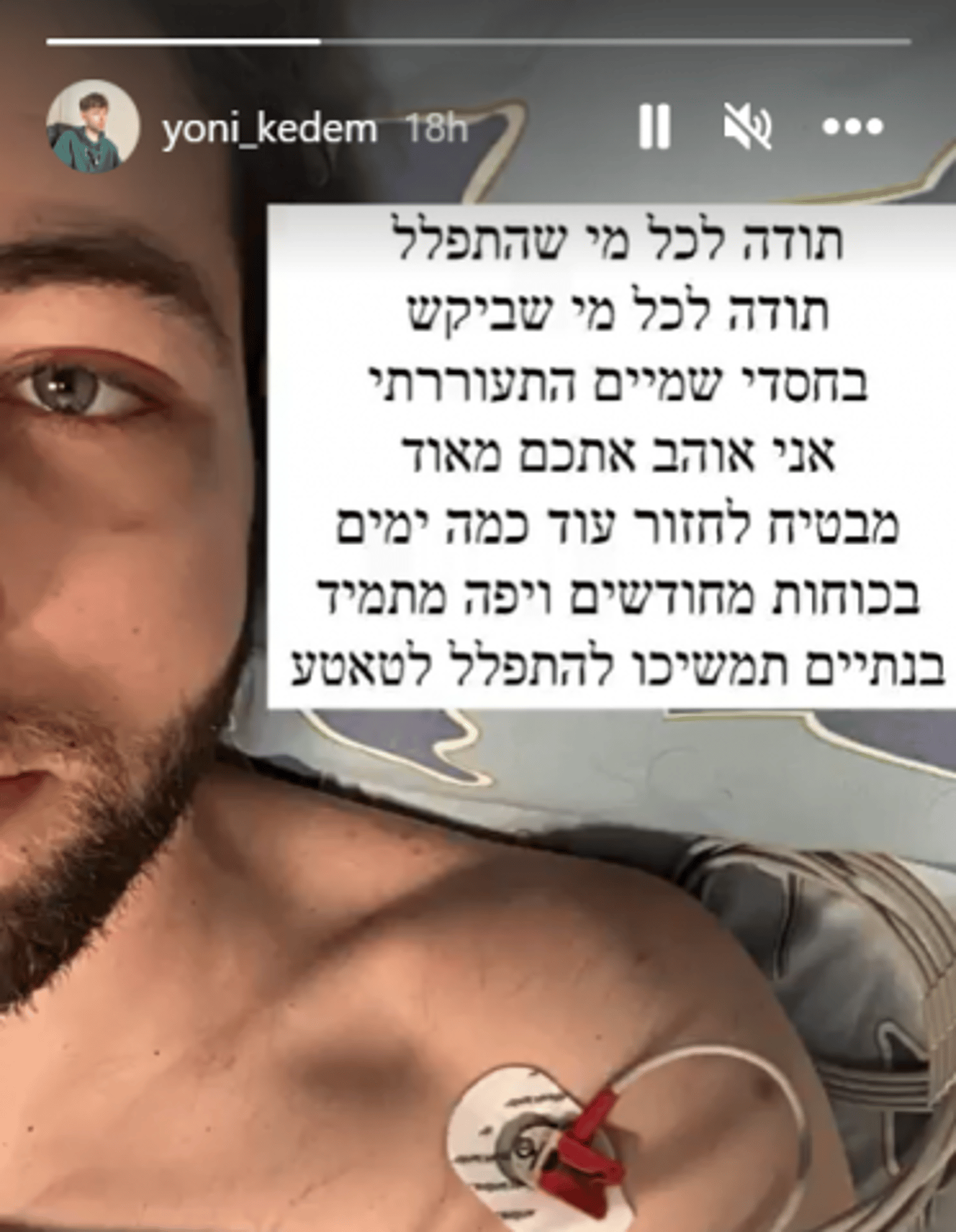 יוני קדם התעורר: "שום דבר לא ברור מאליו"