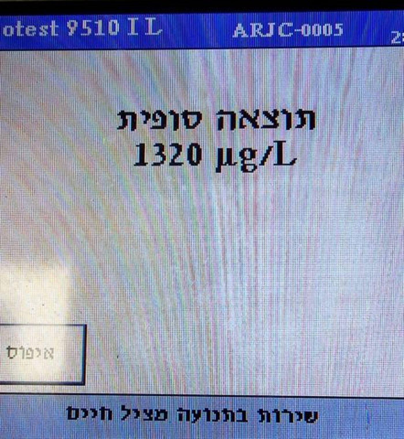 תוצאת הבדיקה של הנהג
