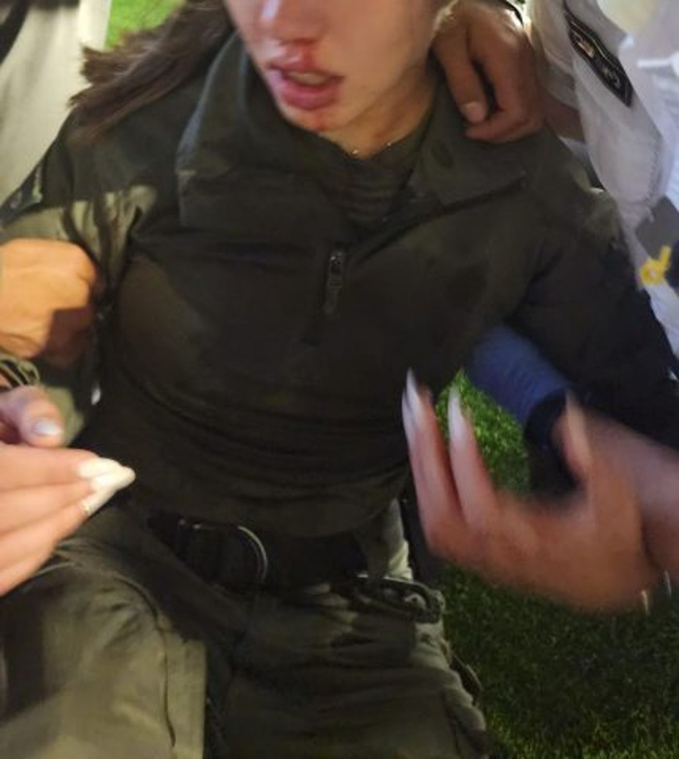 השוטרת שנפצעה בפניה (דוברות המשטרה)