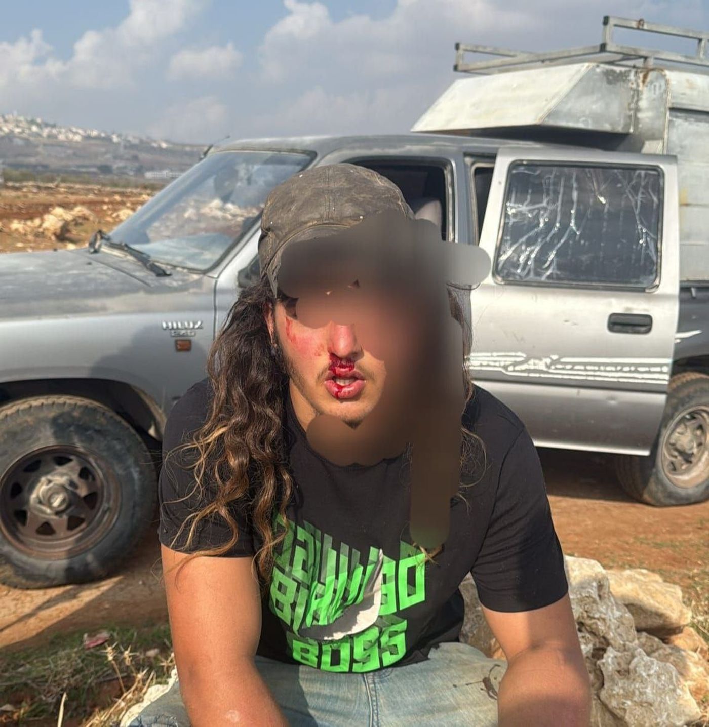 אירוע רודף אירוע: רועה צאן הותקף בבנימין ופונה לבית החולים