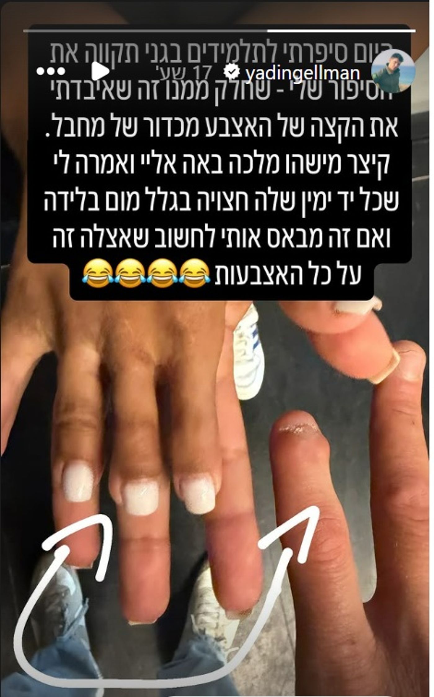 הפציעה של ידין גלמן