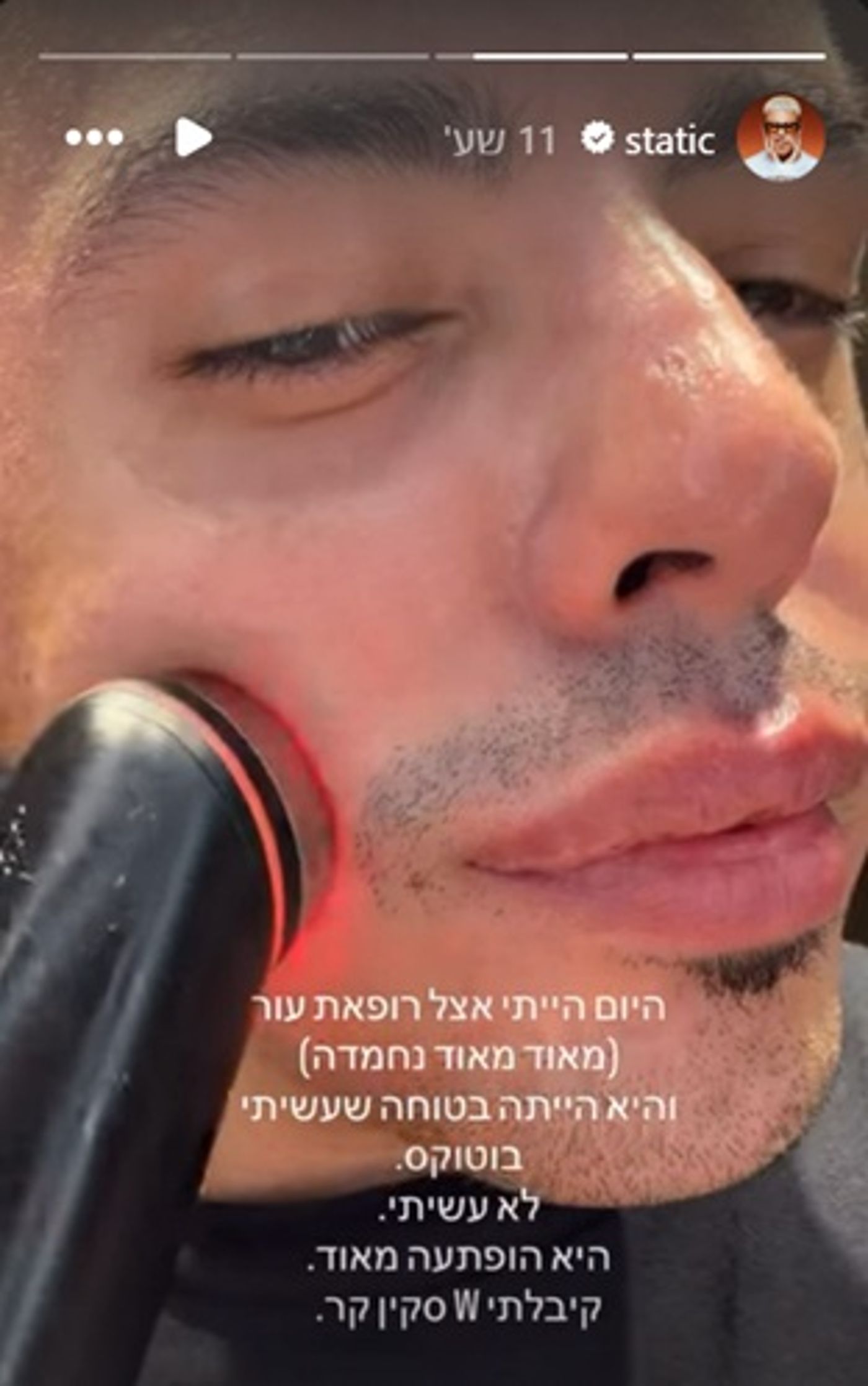 סטטיק אצל רופאת העור