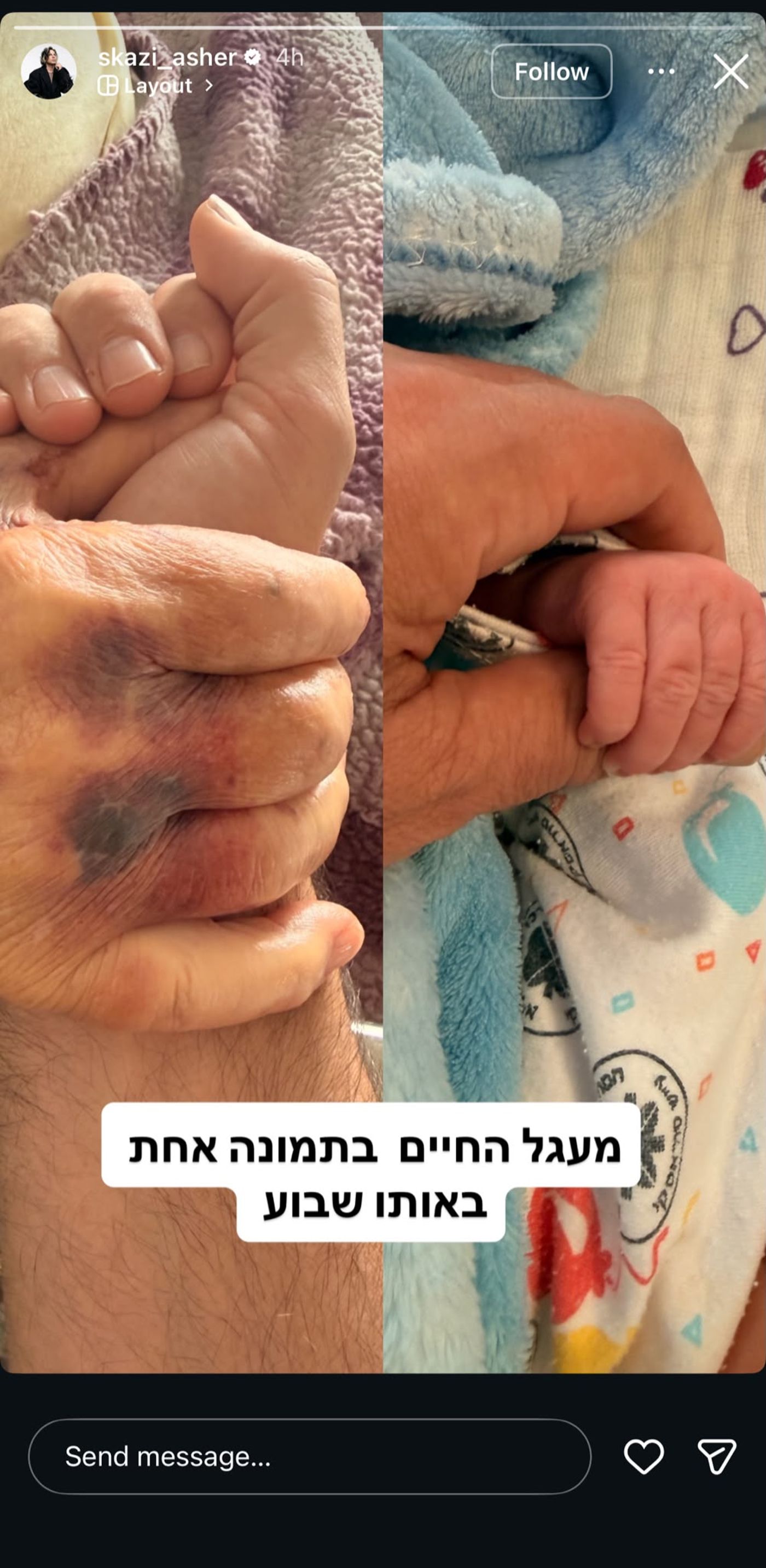 סקאזי