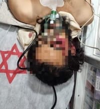 פצוע הלינץ' מהר חברון שב להכרה; מצבו קשה
