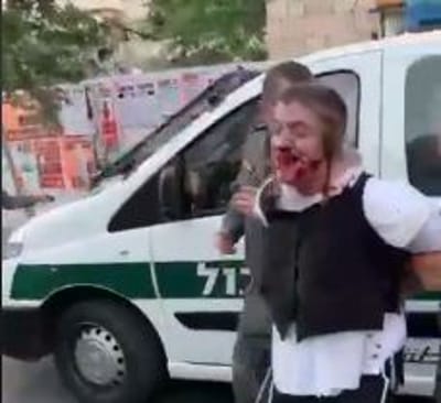 ארדן על תקיפת הנער: "תתבצע בדיקה מקיפה"