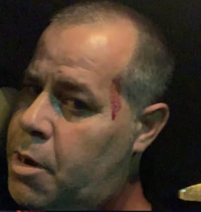 החשוד בתקיפת כתב ישראל היום הורשע בהריגת אדם אחר