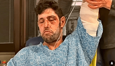 "הכרתי אותה בפאודה": עידן עמדי על האחות שטיפלה בו