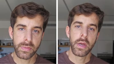 שחף רז מגן על הפיטבול: "לא רוצה לחיות בחברה שהורגת כלבים"