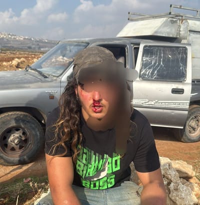 אירוע רודף אירוע: רועה צאן הותקף בבנימין ופונה לבית החולים