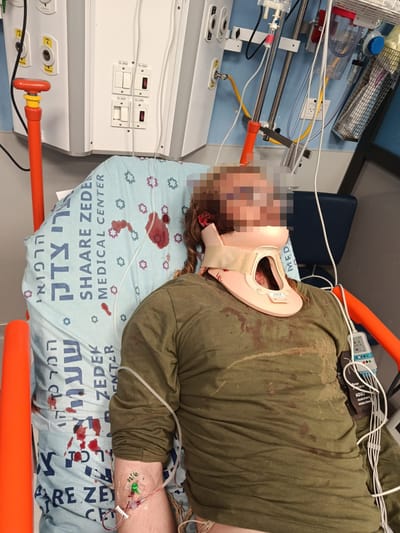 תקיפת רועה במקנה אברהם