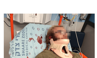 הרועה שהותקף בבית החולים