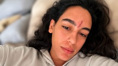 נועם קליינשטיין
