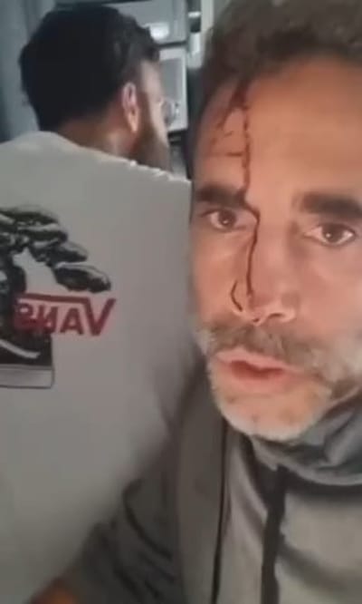 תיעוד המטוס
