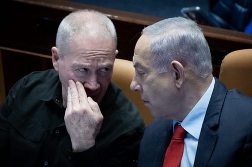 גם מעריצי גלנט צריכים לתמוך בפיטורו; זו הסיבה