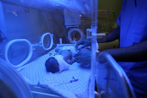 פג נפטר מזיהום חיידקי ברמב"ם; 3 פגים נוספים במצב יציב