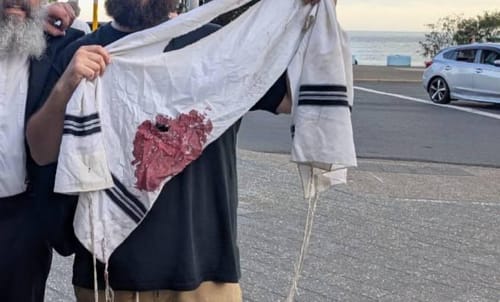 אחרי הפיגוע בבונדי: ממשלת אוסטרליה מודיעה על שינוי מדיניות