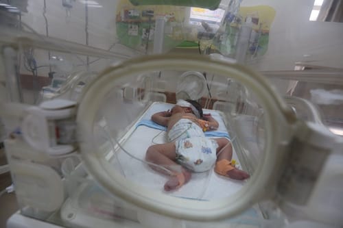 שומר בפגייה של איכילוב אובחן כחולה חצבת
