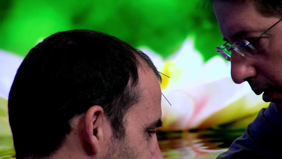 דיקור סיני – דותן