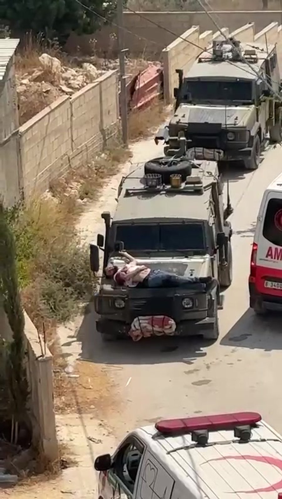 מחבל פצוע