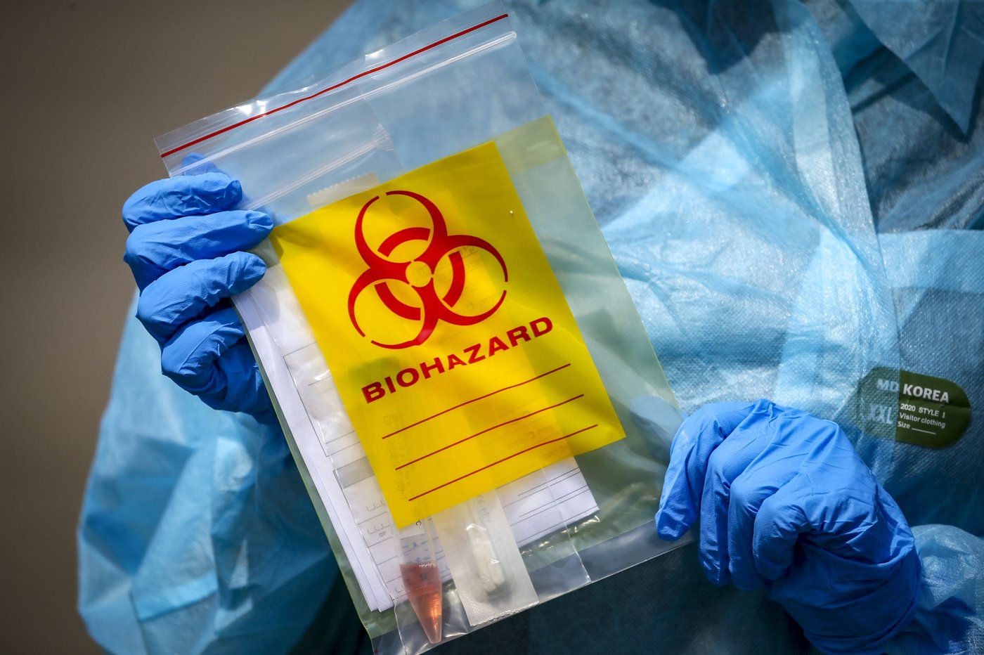 עו"ד על הפרשה • מה דינו של אדם שהדביק בקורונה