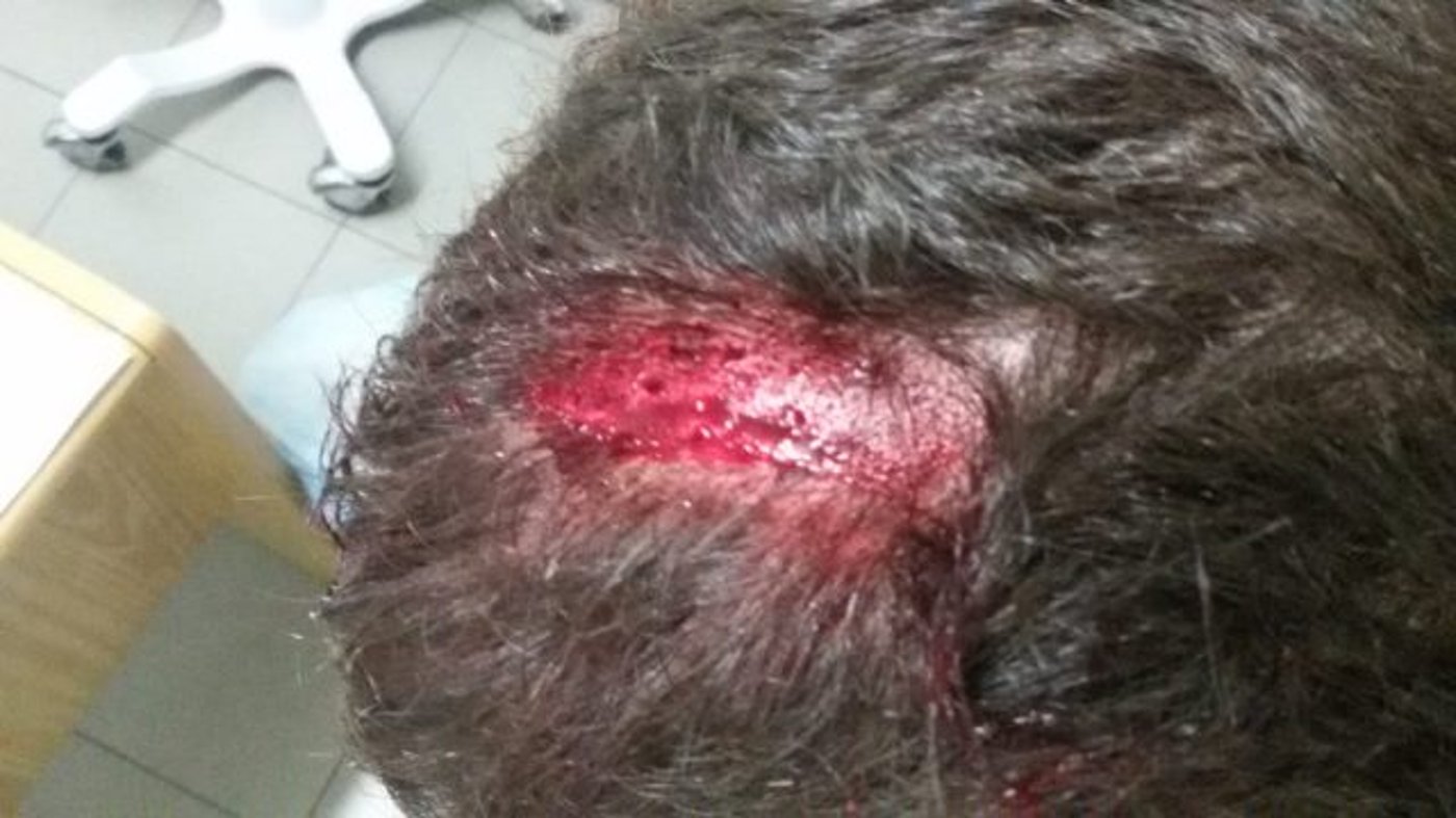 תיעוד: לפני שבת- יהודים עברו לינץ' בצפון