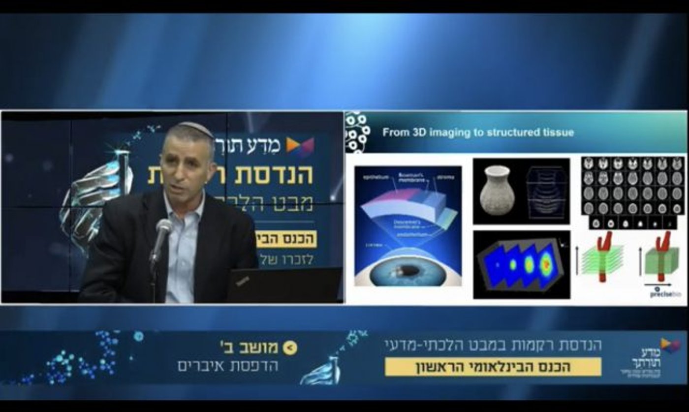 האם סטייק אנטרקוט מתורבת בשרי?
