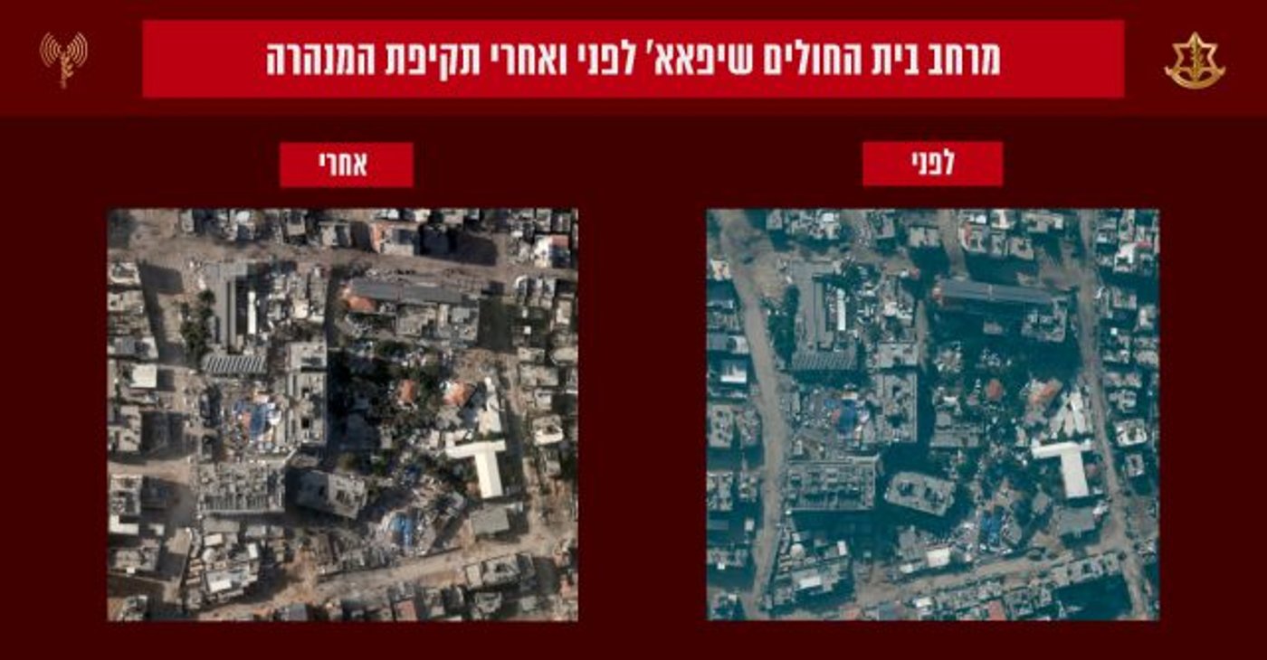 מרחב בית החולים שיפא