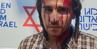 מותקפי הלינץ' בשומרון נעצרו | חוננו: "גיבוי לטרור"