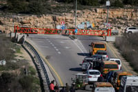 הדסה: פצועת פיגוע הירי מאושפזת במצב קשה