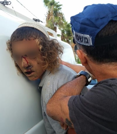 "די לאבדן העשתונות שמלווה את המאבק בתג מחיר"