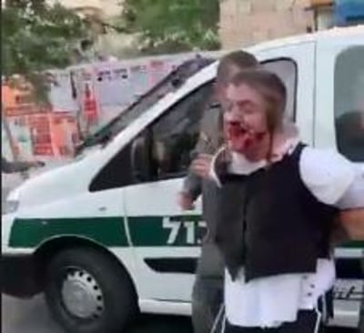 ארדן על תקיפת הנער: "תתבצע בדיקה מקיפה"