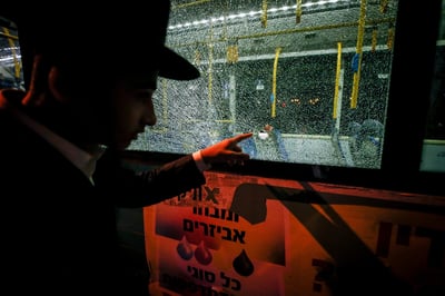 פצוע הפיגוע: "הוציאו קליע שלא ידעתי שהיה בתוכי"