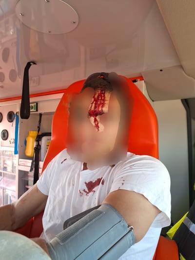 סכנה לחייו: החמרה במצב הפצוע מהלינץ' בבנימין