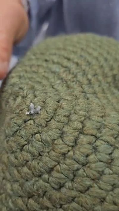 הכיפה עצרה את הרסיס; הפצוע לא נשרט